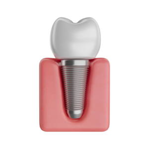 icono implantes dentales especialidad en odontología