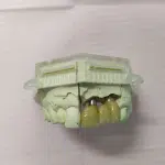 molde implantes dentales