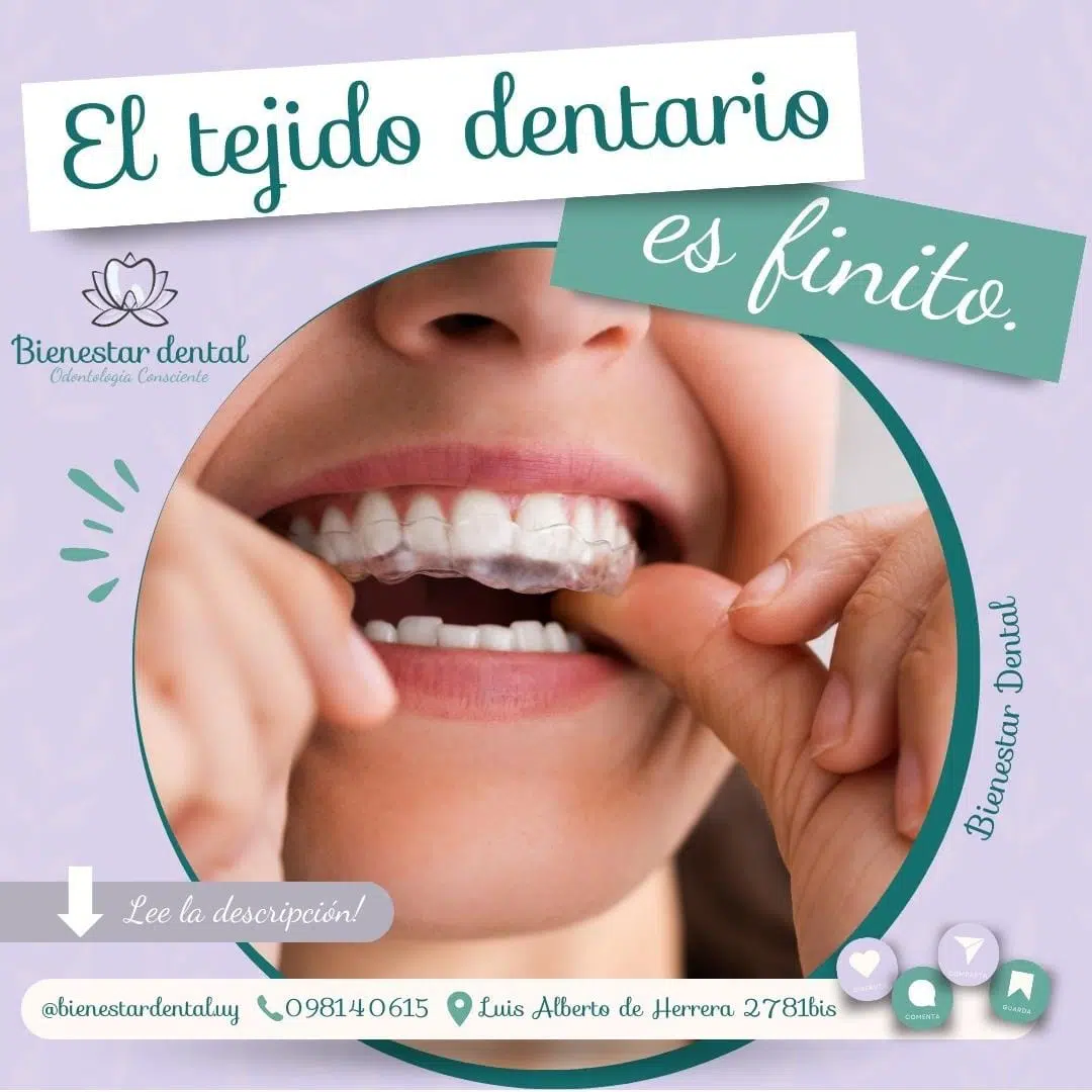 tejido dentario bruxismo